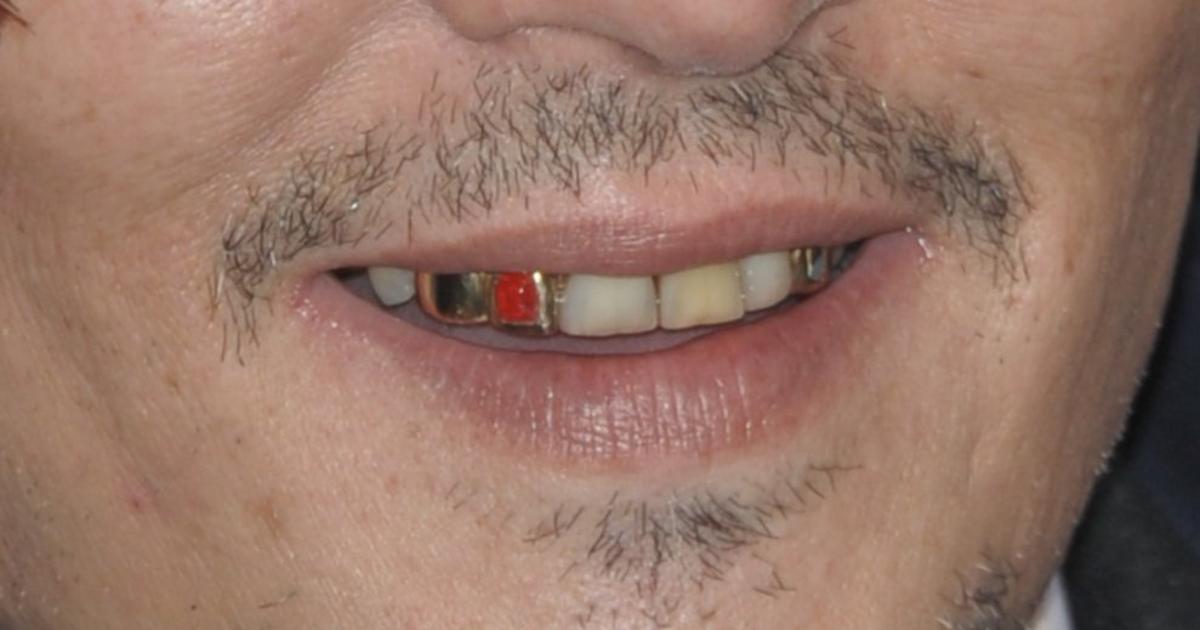 Johnny Depp smile transformation